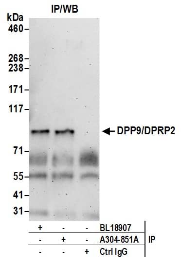 Immunoprecipitation:[NBP3-29437]-Detection of human DPP9/DPRP2 by western blot of immunoprecipitates. Samples: Whole cell lysate from 293T cells prepared using NETN lysis buffer. Antibody: Affinity purified rabbit anti-DPP9/DPRP2 antibody used for IP at 6 µg per reaction. DPP9/DPRP2 was also immunoprecipitated by rabbit anti-DPP9/DPRP2 antibody. For blotting immunoprecipitated DPP9/DPRP2, was used at 0. 4 µg/ml. Detection: Chemiluminescence with an exposure time of 3 minutes.