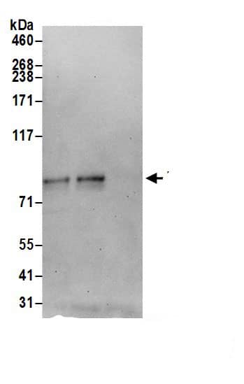 Immunoprecipitation:TMTC3 AntibodyNBP3-29438] -Detection of human TMTC3 by western blot of immunoprecipitates. Samples: Whole cell lysate (1.0 mg per IP reaction; 20% of IP loaded) from 293T cells prepared using NETN lysis buffer. Antibodies: Affinity purified rabbit anti-TMTC3 antibody (NBP3-29438 lot 1) used for IP at 6 µg per reaction. TMTC3 was also immunoprecipitated by rabbit anti-TMTC3.. For blotting immunoprecipitated TMTC3, NBP3-29438 was used at 0.4 mg/ml. Detection: Chemiluminescence with an exposure time of 10 seconds.