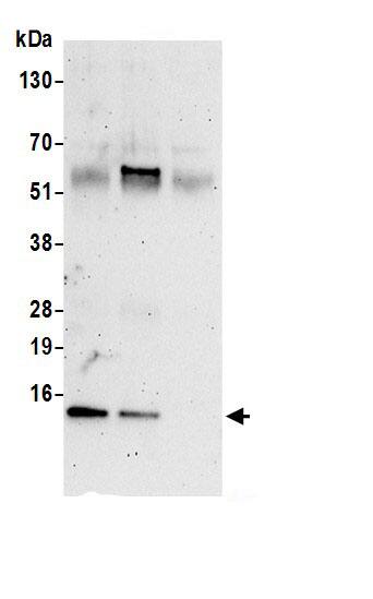 Immunoprecipitation:COX5b AntibodyNBP3-29439] -Detection of human COX5B by western blot of immunoprecipitates. Samples: Whole cell lysate (0.5 or 1.0 mg per IP reaction; 20% of IP loaded) from 293T cells prepared using NETN lysis buffer. Antibodies: Affinity purified rabbit anti-COX5B antibody NBP3-29439 (lot NBP3-29439-1) used for IP at 6 µg per reaction. COX5B was also immunoprecipitated by rabbit anti-COX5B.. For blotting immunoprecipitated COX5B, NBP3-29439 was used at 1 µg/ml. Detection: Chemiluminescence with an exposure time of 3 minutes.