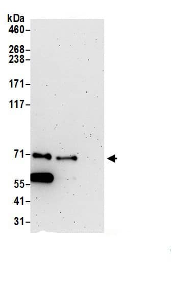 Immunoprecipitation:TBCK AntibodyNBP3-29440] -Detection of human TBCK by western blot of immunoprecipitates. Samples: Whole cell lysate (1.0 mg per IP reaction; 20% of IP loaded) from 293T cells prepared using NETN lysis buffer. Antibodies: Affinity purified rabbit anti-TBCK antibody (NBP3-29440 lot 1) used for IP at 6 µg per reaction. TBCK was also immunoprecipitated by rabbit anti-TBCK antibody. For blotting immunoprecipitated TBCK, NBP3-29440 was used at 0.4 mg/ml0. Detection: Chemiluminescence with an exposure time of 3 minutes.