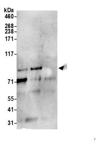 Immunoprecipitation:TTC7A AntibodyNBP3-29441] -Detection of human TTC7A by western blot of immunoprecipitates. Samples: Whole cell lysate (1.0 mg per IP reaction; 20% of IP loaded) from Jurkat cells prepared using NETN lysis buffer. Antibodies: Affinity purified rabbit anti-TTC7A antibody (NBP3-29441 lot 1) used for IP at 6 µg per reaction. TTC7A was also immunoprecipitated by rabbit anti-TTC7A antibody BL23136. For blotting immunoprecipitated TTC7A, NBP3-29441 was used at 0.4 mg/ml. Detection: Chemiluminescence with an exposure time of 3 minutes.