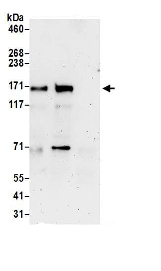 Immunoprecipitation:LDLR AntibodyNBP3-29443] -Detection of human LDLR by western blot of immunoprecipitates. Samples: Whole cell lysate (1 mg for IP; 20% of IP loaded) prepared using NETN buffer from HeLa cells. Antibodies: Affinity purified rabbit anti-LDLR antibody NBP3-29443 (lot NBP3-29443-1) used for IP at 6 µg per reaction. LDLR was also immunoprecipitated by rabbit anti-LDLR antibody. For blotting immunoprecipitated LDLR, NBP3-29443 was used at 1 µg/ml. Detection: Chemiluminescence with an exposure time of 3 minutes.