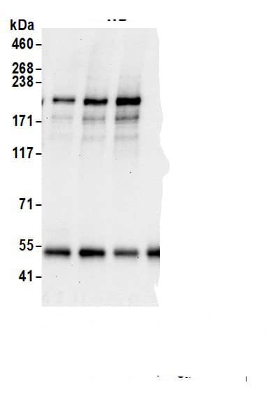 Immunoprecipitation:CEP152 AntibodyNBP3-29445] -Detection of human CEP152 by western blot of immunoprecipitates. Samples: Whole cell lysate (1 mg per IP; 10% of IP loaded) from HeLa cells prepared using NETN lysis buffer. Antibodies: Affinity purified rabbit anti-CEP152 antibody (NBP3-29445 lot 2) used for IP at 6 µg per reaction. CEP152 was also immunoprecipitated by a previous lot of this antibody (NBP3-29445 lot 1) and a second.inst a different epitope of CEP152 . For blotting immunoprecipitated CEP152, NBP3-29445 was used at 1 µg/ml. Detection: Chemiluminescence with an exposure time of 75 seconds.