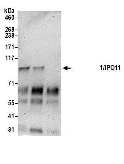 Immunoprecipitation:Importin 11 AntibodyNBP3-29448] -Detection of human Importin 11/IPO11 by western blot of immunoprecipitates. Samples: Whole cell lysate (0.5 or 1.0 mg per IP reaction; 20% of IP loaded) from 293T cells prepared using NETN lysis buffer. Antibody: Affinity purified rabbit anti-Importin 11/IPO11 antibody NBP3-29448 (lot NBP3-29448-1) used for IP at 6 µg per reaction. Importin 11/IPO11 was also immunoprecipitated by rabbit anti-Importin 11/IPO11.. For blotting immunoprecipitated Importin 11/IPO11, A304-811A was used at 0.4 µg/ml. Detection: Chemiluminescence with an exposure time of 3 minutes.