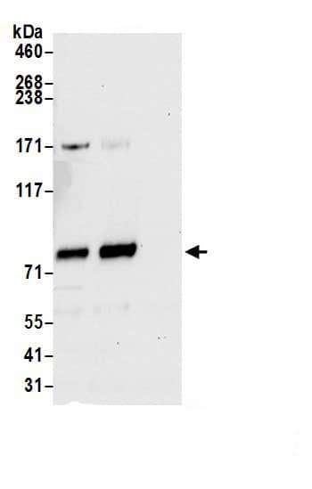 Immunoprecipitation:TMTC3 AntibodyNBP3-29449] -Detection of human TMTC3 by western blot of immunoprecipitates. Samples: Whole cell lysate (1.0 mg per IP reaction; 20% of IP loaded) from 293T cells prepared using NETN lysis buffer. Antibodies: Affinity purified rabbit anti-TMTC3 antibody (NBP3-29449 lot 1) used for IP at 6 µg per reaction. TMTC3 was also immunoprecipitated by rabbit anti-TMTC3.. For blotting immunoprecipitated TMTC3, NBP3-29449 was used at 0.4 mg/ml. Detection: Chemiluminescence with an exposure time of 10 seconds.