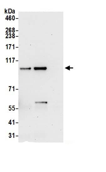 Immunoprecipitation:SPATA5 AntibodyNBP3-29450] -Detection of human SPATA5 by western blot of immunoprecipitates. Samples: Whole cell lysate (0.5 or 1.0 mg per IP reaction; 20% of IP loaded) from HeLa cells prepared using NETN lysis buffer. Antibodies: Affinity purified rabbit anti-SPATA5 antibody NBP3-29450 (lot NBP3-29450-1) used for IP at 6 µg per reaction. SPATA5 was also immunoprecipitated by rabbit anti-SPATA5.. For blotting immunoprecipitated SPATA5, NBP3-29450 was used at 1 µg/ml. Detection: Chemiluminescence with an exposure time of 30 seconds.