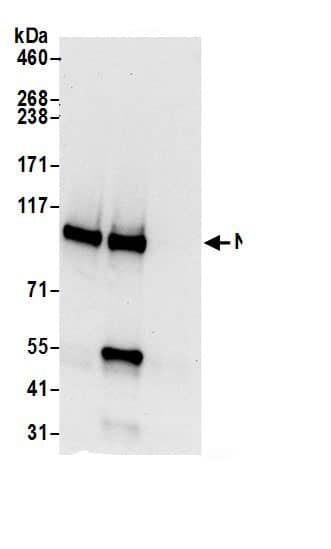 Immunoprecipitation:NCKAP1 AntibodyNBP3-29455] -Detection of human NCKAP1 by western blot of immunoprecipitates. Samples: Whole cell lysate (0.5 or 1.0 mg per IP reaction; 20% of IP loaded) from 293T cells prepared using NETN lysis buffer. Antibodies: Affinity purified rabbit anti-NCKAP1 antibody NBP3-29455 (lot NBP3-29455-1) used for IP at 6 µg per reaction. NCKAP1 was also immunoprecipitated by rabbit anti-NCKAP1.. For blotting immunoprecipitated NCKAP1, NBP3-29455 was used at 0.4 µg/ml. Detection: Chemiluminescence with an exposure time of 10 seconds.