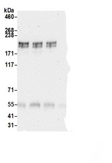 Immunoprecipitation:GLI-2 AntibodyNBP3-29457] -Detection of human GLI2 by western blot of immunoprecipitates. Samples: Whole cell lysate (0.5 or 1.0 mg per IP reaction; 20% of IP loaded) from HeLa cells prepared using NETN lysis buffer. Antibodies: Affinity purified rabbit anti-GLI2 antibody NBP3-29457 (lot NBP3-29457-1) used for IP at 6 µg per reaction. GLI2 was also immunoprecipitated by rabbit anti-GLI2 antibodies BL20733 and BL20735. For blotting immunoprecipitated GLI2, NBP3-29457 was used at 1 µg/ml. Detection: Chemiluminescence with an exposure time of 30 seconds.