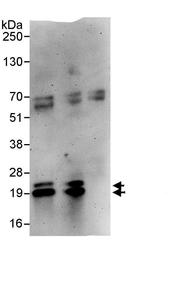 Immunoprecipitation:PPP1R14B AntibodyNBP3-29459] -Detection of human PPP1R14B by western blot of immunoprecipitates. Samples: Whole cell lysate (1 mg for IP, 20% of IP loaded) from HeLa cells. Antibodies: Affinity purified rabbit anti-PPP1R14B antibody NBP3-29459 used for IP at 10 µg/mg lysate. PPP1R14B was also immunoprecipitated by rabbit anti-PPP1R14B., which recognizes an upstream epitope. For blotting immunoprecipitated PPP1R14B, NBP3-29459 was used at 1 µg/ml. Detection: Chemiluminescence with an exposure time of 3 minutes.