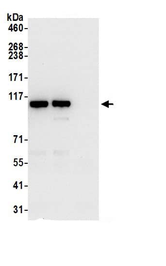 Immunoprecipitation:PITRM1 AntibodyNBP3-29462] -Detection of human PITRM1 by western blot of immunoprecipitates. Samples: Whole cell lysate (0.5 or 1.0 mg per IP reaction; 20% of IP loaded) from 293T cells prepared using NETN lysis buffer. Antibodies: Affinity purified rabbit anti-PITRM1 antibody NBP3-29462 (lot NBP3-29462-1) used for IP at 6 µg per reaction. PITRM1 was also immunoprecipitated by rabbit anti-PITRM1 antibody BL21664. For blotting immunoprecipitated PITRM1, NBP3-29462 was used at 0.4 µg/ml. Detection: Chemiluminescence with an exposure time of 10 seconds.