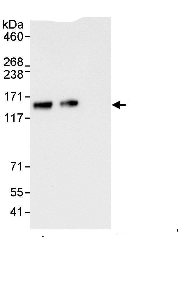 Immunoprecipitation:Sin3A-associated protein AntibodyNBP3-29463] -Detection of human SAP130 by western blot of immunoprecipitates. Samples: Whole cell lysate (1 mg for IP, 20% of IP loaded) from HeLa cells. Antibodies: Affinity purified rabbit anti-SAP130 antibody NBP3-29463 used for IP at 3 µg/mg lysate. SAP130 was also immunoprecipitated by rabbit anti-SAP130., which recognizes an upstream epitope. For blotting immunoprecipitated SAP130, A302-490A was used at 0.4 µg/ml. Detection: Chemiluminescence with an exposure time of 10 seconds.