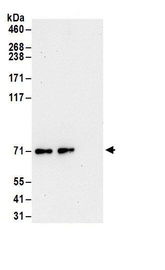 Immunoprecipitation:RSK3 AntibodyNBP3-29468] -Detection of human RSK3 by western blot of immunoprecipitates. Samples: Whole cell lysate (1 mg for IP; 20% of IP loaded) from HeLa cells. Antibodies: Affinity purified rabbit anti-RSK3 antibody NBP3-29468 (lot NBP3-29468-1) used for IP at 6 µg/mg lysate. RSK3 was also immunoprecipitated by rabbit anti-RSK3.. For blotting immunoprecipitated RSK3, A304-244A was used at 1 µg/ml. Detection: Chemiluminescence with an exposure time of 30 seconds.