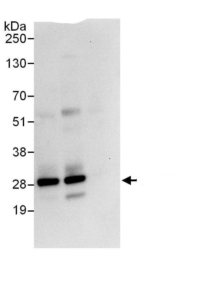 Immunoprecipitation:mtTFA AntibodyNBP3-29470] -Detection of human TFAM by western blot of immunoprecipitates. Samples: Whole cell lysate (1 mg for IP, 20% of IP loaded) from HeLa cells. Antibodies: Affinity purified rabbit anti-TFAM antibody NBP3-29470 used for IP at 6 µg/mg lysate. TFAM was also immunoprecipitated by rabbit anti-TFAM., which recognizes a downstream epitope. For blotting immunoprecipitated TFAM, A303-226A was used at 1 µg/ml. Detection: Chemiluminescence with an exposure time of 10 seconds.