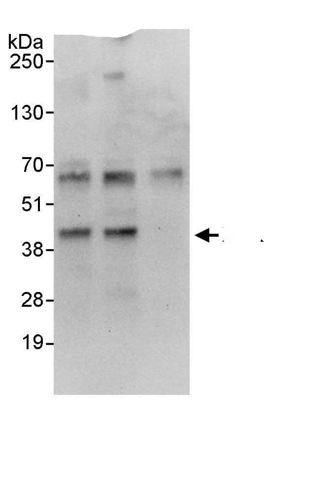 Immunoprecipitation:EAF2 AntibodyNBP3-29472] -Detection of human EAF2 by western blot of immunoprecipitates. Samples: Whole cell lysate (1 mg for IP, 20% of IP loaded) from HeLa cells. Antibodies: Affinity purified rabbit anti-EAF2 antibody NBP3-29472 used for IP at 3 µg/mg lysate. EAF2 was also immunoprecipitated by rabbit anti-EAF2., which recognizes a downstream epitope. For blotting immunoprecipitated EAF2,  was used at 1 µg/ml. Detection: Chemiluminescence with an exposure time 30 seconds.