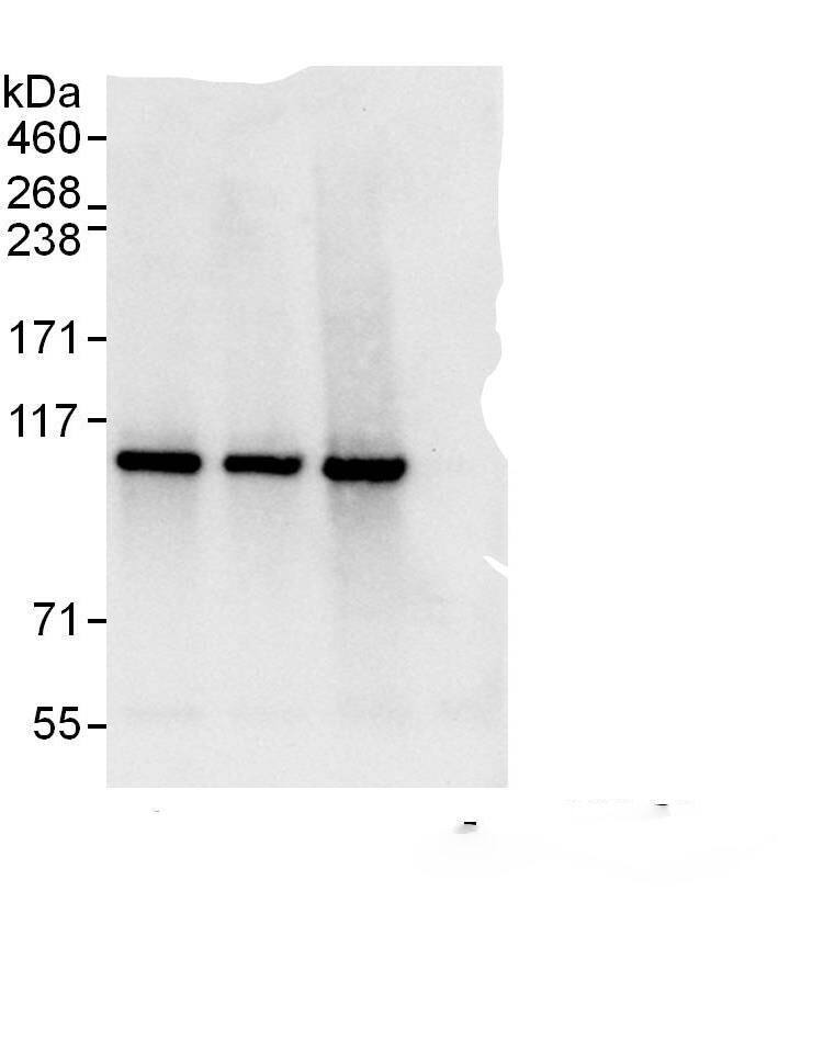 Immunoprecipitation:STAT2 AntibodyNBP3-29475] -Detection of human STAT2 by western blot of immunoprecipitates. Samples: Whole cell lysate (1 mg for IP, 20% of IP loaded) from Jurkat cells. Antibodies: Affinity purified rabbit anti-STAT2 antibody NBP3-29475 used for IP at 6 µg/mg lysate. STAT2 was also immunoprecipitated by rabbit anti-STAT2 antibodies A303-511A and A303-512A, which recognize downstream epitopes. For blotting immunoprecipitated STAT2, A303-512A was used at 1 µg/ml. Detection: Chemiluminescence with an exposure time of 3 seconds.