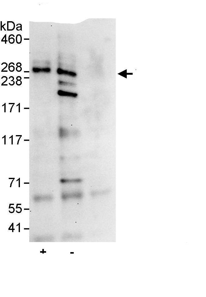 Immunoprecipitation:SLX4 AntibodyNBP3-29477] -Detection of human BTBD12 by western blot of immunoprecipitates. Samples: Whole cell lysate (1 mg for IP, 20% of IP loaded) from HeLa cells. Antibodies: Affinity purified rabbit anti-BTBD12 antibody NBP3-29477 used for IP at 10 µg/mg lysate. BTBD12 was also immunoprecipitated by rabbit anti-BTBD12., which recognizes an upstream epitope. For blotting immunoprecipitated BTBD12, NBP3-29477 was used at 1 µg/ml. Detection: Chemiluminescence with an exposure time of 30 seconds.