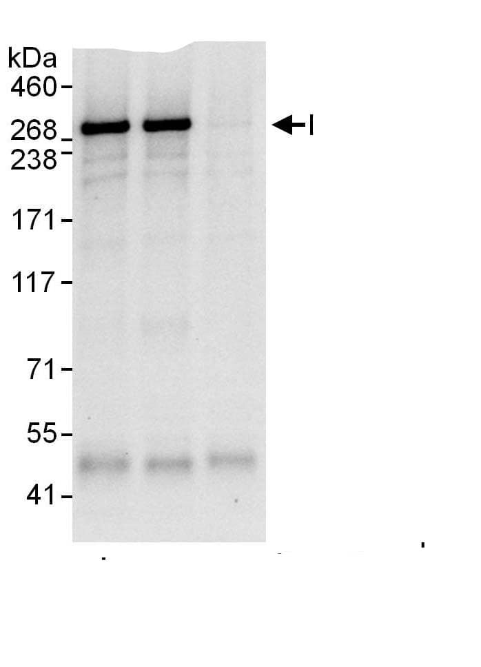 Immunoprecipitation:Desmoplakin AntibodyNBP3-29478] -Detection of human Desmoplakin by western blot of immunoprecipitates. Samples: Whole cell lysate (1 mg for IP, 20% of IP loaded) from HeLa cells. Antibodies: Affinity purified rabbit anti-Desmoplakin antibody NBP3-29478 used for IP at 6 µg/mg lysate. Desmoplakin was also immunoprecipitated by rabbit anti-Desmoplakin., which recognizes an upstream epitope. For blotting immunoprecipitated Desmoplakin,  was used at 1 µg/ml. Detection: Chemiluminescence with an exposure time of 10 seconds.