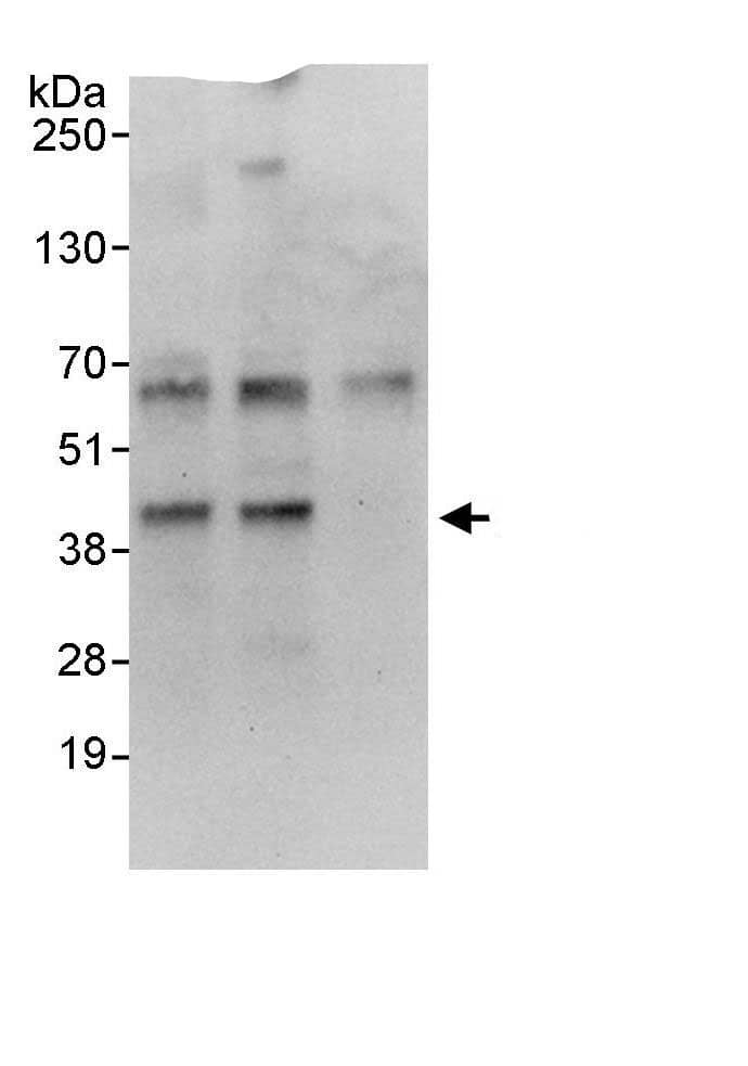 Immunoprecipitation:EAF2 AntibodyNBP3-29480] -Detection of human EAF2 by western blot of immunoprecipitates. Samples: Whole cell lysate (1 mg for IP, 20% of IP loaded) from HeLa cells. Antibodies: Affinity purified rabbit anti-EAF2 antibody NBP3-29480 used for IP at 3 µg/mg lysate. EAF2 was also immunoprecipitated by rabbit anti-EAF2., which recognizes an upstream epitope. For blotting immunoprecipitated EAF2, NBP3-29480 was used at 1 µg/ml. Detection: Chemiluminescence with an exposure time 30 seconds.
