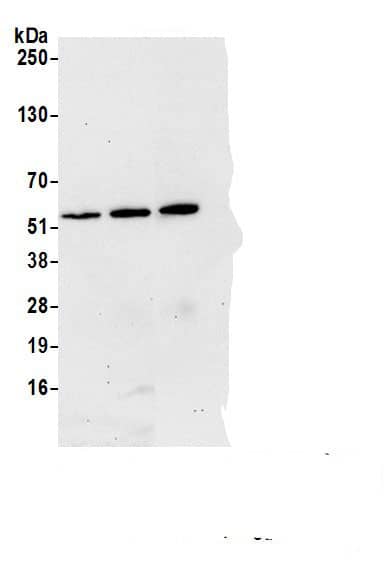 Immunoprecipitation:RBM17 AntibodyNBP3-29482] -Detection of human SPF45 by western blot of immunoprecipitates. Samples: Whole cell lysate (1.0 mg per IP reaction; 20% of IP loaded) from HeLa cells prepared using NETN lysis buffer. Antibodies: Affinity purified rabbit anti-SPF45 antibody NBP3-29482 (lot NBP3-29482-3) used for IP at 6 µg per reaction. SPF45 was also immunoprecipitated by a previous lot of this antibody (lot NBP3-29482-2) and rabbit anti-SPF45.. For blotting immunoprecipitated SPF45, NBP3-29482 was used at 0.1 µg/ml. Detection: Chemiluminescence with an exposure time of 30 seconds.
