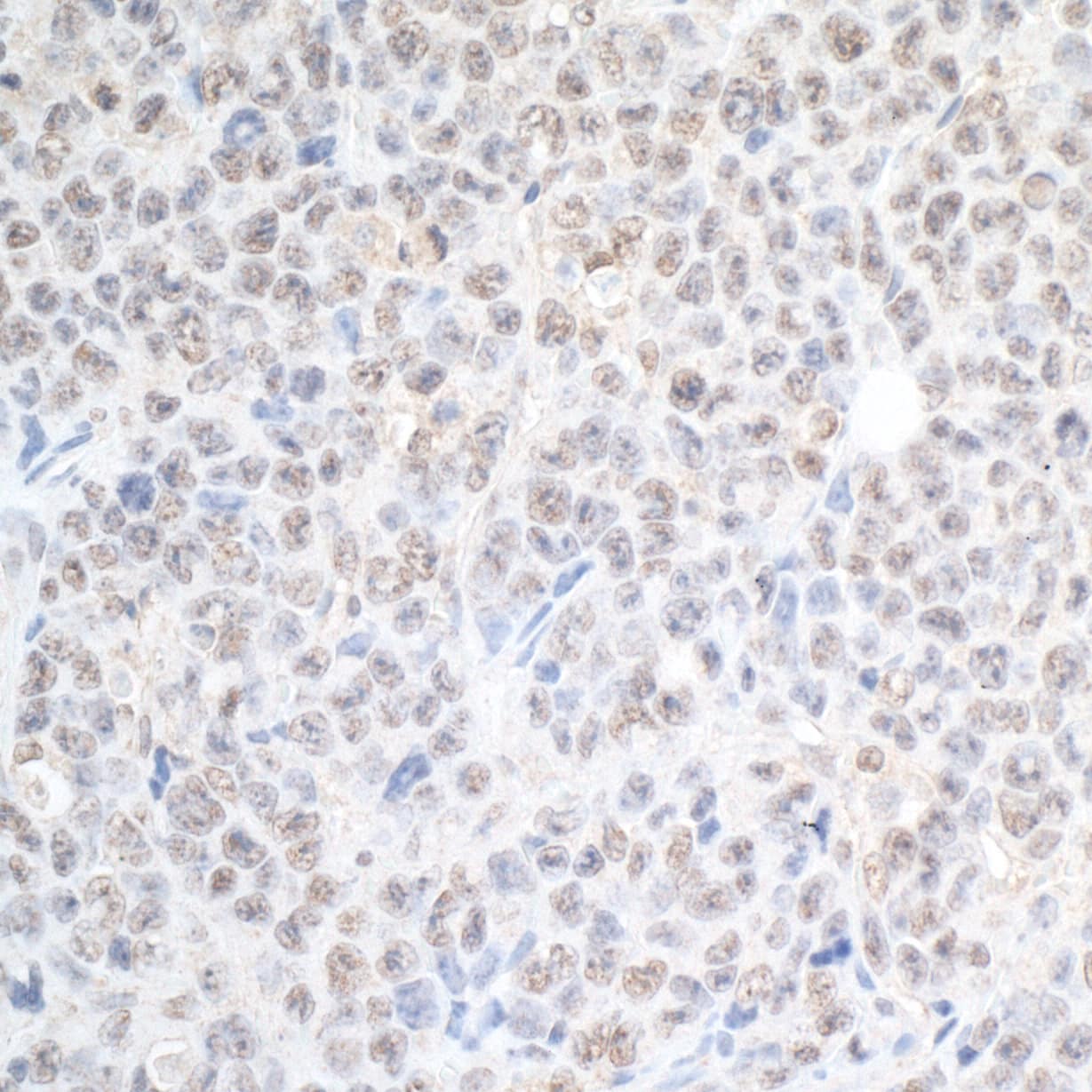 Immunohistochemistry;RBM17 Antibody[NBP3-29481]Detection of mouse SPF45 by immunohistochemistry. Sample: FFPE section of mouse plasmacytoma. Antibody: Affinity purified rabbit anti-SPF45  used at a dilution of 1:5,000 . Detection: DAB