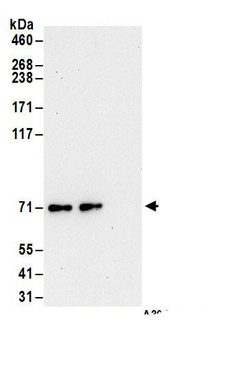 Immunoprecipitation:RSK3 AntibodyNBP3-29483] -Detection of human RSK3 by western blot of immunoprecipitates. Samples: Whole cell lysate (1 mg for IP; 20% of IP loaded) from HeLa cells. Antibodies: Affinity purified rabbit anti-RSK3 antibody NBP3-29483 (lot NBP3-29483-1) used for IP at 6 µg/mg lysate. RSK3 was also immunoprecipitated by rabbit anti-RSK3.. For blotting immunoprecipitated RSK3, NBP3-29483 was used at 1 µg/ml. Detection: Chemiluminescence with an exposure time of 30 seconds.