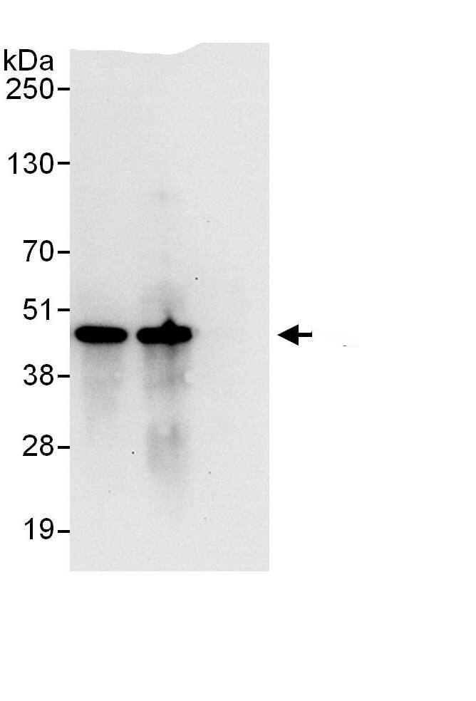 Immunoprecipitation:PSMC6 AntibodyNBP3-29490] -Detection of human PSMC6 by western blot of immunoprecipitates. Samples: Whole cell lysate (1 mg for IP, 20% of IP loaded) from HEK293T cells. Antibodies: Affinity purified rabbit anti-PSMC6 antibody NBP3-29490 used for IP at 6 µg/mg lysate. PSMC6 was also immunoprecipitated by rabbit anti-PSMC6., which recognizes a downstream epitope. For blotting immunoprecipitated PSMC6, was used at 1 µg/ml. Detection: Chemiluminescence with an exposure time of 10 seconds.