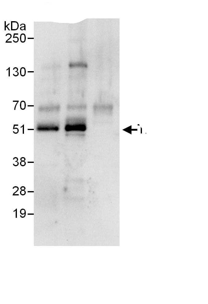 Immunoprecipitation:TXNIP AntibodyNBP3-29491] -Detection of human TXNIP by western blot of immunoprecipitates. Samples: Whole cell lysate (1 mg for IP, 20% of IP loaded) from HeLa cells. Antibodies: Affinity purified rabbit anti-TXNIP antibody NBP3-29491 used for IP at 6 µg/mg lysate. TXNIP was also immunoprecipitated by rabbit anti-TXNIP antibody BL11547, which recognizes an upstream epitope. For blotting immunoprecipitated TXNIP, NBP3-29491 was used at 1 µg/ml. Detection: Chemiluminescence with an exposure time of 10 seconds.