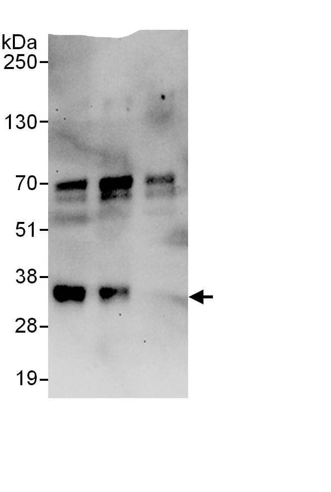 Immunoprecipitation:SFRS7 AntibodyNBP3-29495] -Detection of human SRSF7 by western blot of immunoprecipitates. Samples: Whole cell lysate (1 mg for IP, 20% of IP loaded) from HeLa cells. Antibodies: Affinity purified rabbit anti-SRSF7 antibody NBP3-29495 used for IP at 6 µg/mg lysate. SRSF7 was also immunoprecipitated by rabbit anti-SRSF7., which recognizes a downstream epitope. For blotting immunoprecipitated SRSF7,  was used at 1 µg/ml. Detection: Chemiluminescence with an exposure time of 30 seconds.