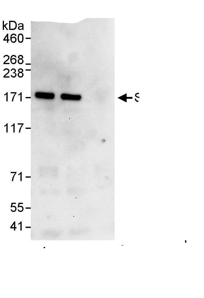 Immunoprecipitation:ZEB2 AntibodyNBP3-29496] -Detection of human ZEB2/SIP by western blot of immunoprecipitates. Samples: Whole cell lysate (1 mg for IP, 20% of IP loaded) from HeLa cells. Antibodies: Affinity purified rabbit anti-ZEB2/SIP antibody NBP3-29496 used for IP at 3 µg/mg lysate. ZEB2/SIP was also immunoprecipitated by rabbit anti-ZEB2/SIP., which recognizes a downstream epitope. For blotting immunoprecipitated ZEB2/SIP, A302-474A was used at 1 µg/ml. Detection: Chemiluminescence with an exposure time of 30 seconds.