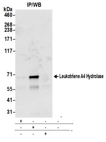 Immunoprecipitation:[NBP3-29499]-Detection of human Leukotriene A4 Hydrolase by western blot of immunoprecipitates. Samples: Whole cell lysate from 293T cells prepared using NETN lysis buffer. Antibodies: Affinity purified rabbit anti-Leukotriene A4 Hydrolase antibody used for IP at 6 µg per reaction. Leukotriene A4 Hydrolase was also immunoprecipitated by rabbit anti-Leukotriene A4 Hydrolase antibody. For blotting immunoprecipitated Leukotriene A4 Hydrolase, was used at 1 µg/ml. Detection: Chemiluminescence with an exposure time of 3 minutes.