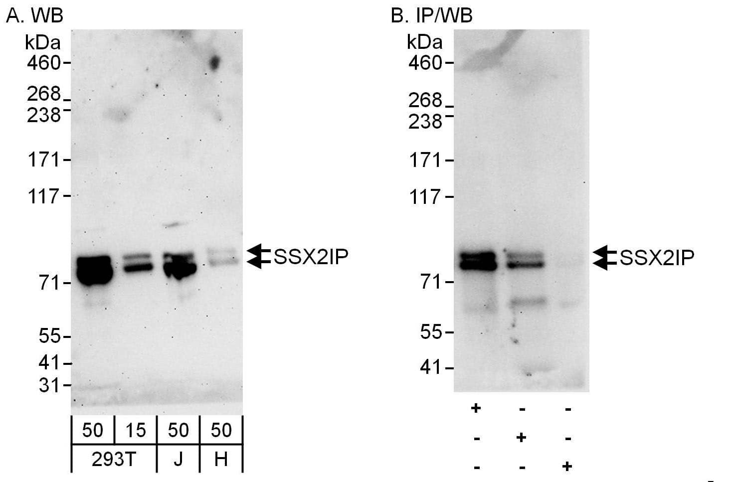 Western Blot:[NBP3-29500]-Detection of human SSX2IP by western blot and immunoprecipitation. Samples: Whole cell lysate from HEK293T , Jurkat and HeLa cells. Antibodies: Affinity purified rabbit anti-SSX2IP antibody used for WB at 0. 4 µg/ml and 1 µg/ml and used for IP at 6 µg/mg lysate. SSX2IP was also immunoprecipitated by rabbit anti-SSX2IP antibody , which recognizes an upstream epitope. Detection: Chemiluminescence with exposure times of 3 minutes and 30 seconds.