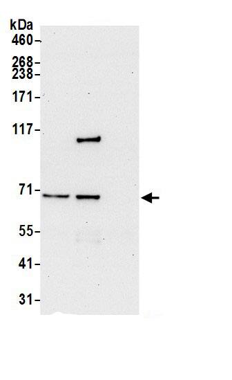 Immunoprecipitation:ATP6V1A AntibodyNBP3-29501] -Detection of human ATP6V1A by western blot of immunoprecipitates. Samples: Whole cell lysate (0.5 or 1.0 mg per IP reaction; 20% of IP loaded) from 293T cells prepared using NETN lysis buffer. Antibodies: Affinity purified rabbit anti-ATP6V1A antibody NBP3-29501 (lot NBP3-29501-1) used for IP at 6 µg per reaction. ATP6V1A was also immunoprecipitated by rabbit anti-ATP6V1A.. For blotting immunoprecipitated ATP6V1A, NBP3-29501 was used at 0.4 µg/ml. Detection: Chemiluminescence with an exposure time of 30 seconds.