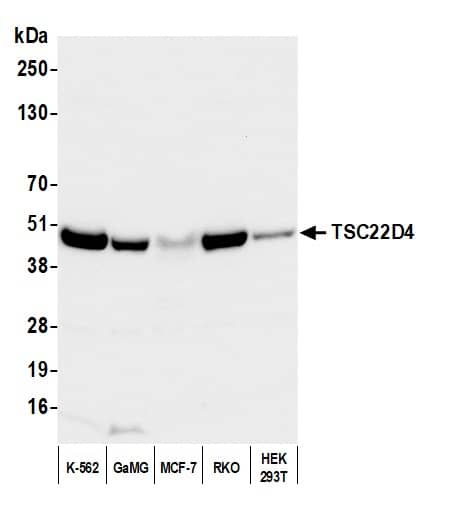 Western Blot:[NBP3-29506]-Detection of human TSC22D4 by western blot. Samples: Whole cell lysate from HeLa , HEK293T and Jurkat cells. Antibodies: Affinity purified rabbit anti-TSC22D4 antibody used for WB at 0. 4 µg/ml and 1 µg/ml and used for IP at 6 µg/mg lysate. TSC22D4 was also immunoprecipitated by rabbit anti-TSC22D4 antibody , which recognizes an upstream epitope. Detection: Chemiluminescence with exposure times of 30 seconds.