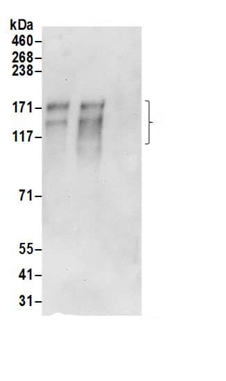 Immunoprecipitation:AE2 AntibodyNBP3-29509] -Detection of human AE2 by western blot of immunoprecipitates. Samples: Whole cell lysate (0.5 or 1.0 mg per IP reaction; 20% of IP loaded) from 293T cells prepared using RIPA lysis buffer. Antibodies: Affinity purified rabbit anti-AE2 antibody NBP3-29509 (lot NBP3-29509-1) used for IP at 6 µg per reaction. AE2 was also immunoprecipitated by rabbit anti-AE2.. For blotting immunoprecipitated AE2, A304-503A was used at 1 µg/ml. Detection: Chemiluminescence with an exposure time of 30 seconds.