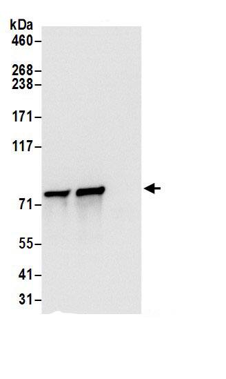 Immunoprecipitation:DYNC1I2 AntibodyNBP3-29510] -Detection of human DYNC1I2 by western blot of immunoprecipitates. Samples: Whole cell lysate (0.5 or 1.0 mg per IP reaction; 20% of IP loaded) from 293T cells prepared using NETN lysis buffer. Antibodies: Affinity purified rabbit anti-DYNC1I2 antibody NBP3-29510 (lot NBP3-29510-1) used for IP at 6 µg per reaction. DYNC1I2 was also immunoprecipitated by rabbit anti-DYNC1I2.. For blotting immunoprecipitated DYNC1I2, NBP3-29510 was used at 1 µg/ml. Detection: Chemiluminescence with an exposure time of 3 seconds.