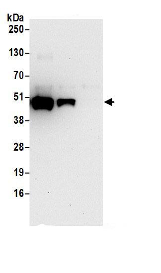 Immunoprecipitation:ADE2 AntibodyNBP3-29511] -Detection of human ADE2 by western blot of immunoprecipitates. Samples: Whole cell lysate (0.5 or 1.0 mg per IP reaction; 20% of IP loaded) from 293T cells prepared using NETN lysis buffer. Antibodies: Affinity purified rabbit anti-ADE2 antibody NBP3-29511 (lot NBP3-29511-1) used for IP at 6 µg per reaction. ADE2 was also immunoprecipitated by rabbit anti-ADE2.. For blotting immunoprecipitated ADE2, NBP3-29511 was used at 0.4 µg/ml. Detection: Chemiluminescence with an exposure time of 30 seconds.