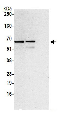 Immunoprecipitation:YARS AntibodyNBP3-29512] -Detection of human YARS by western blot of immunoprecipitates. Samples: Whole cell lysate (0.5 or 1.0 mg per IP reaction; 20% of IP loaded) from 293T cells prepared using NETN lysis buffer. Antibodies: Affinity purified rabbit anti-YARS antibody NBP3-29512 (lot NBP3-29512-1) used for IP at 6 µg per reaction. YARS was also immunoprecipitated by rabbit anti-YARS antibody BL19937. For blotting immunoprecipitated YARS, NBP3-29512 was used at 0.4 µg/ml. Detection: Chemiluminescence with an exposure time of 30 seconds.