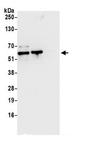 Immunoprecipitation:CCDC47 AntibodyNBP3-29514] -Detection of human CCDC47 by western blot of immunoprecipitates. Samples: Whole cell lysate (0.5 or 1.0 mg per IP reaction; 20% of IP loaded) from 293T cells prepared using NETN lysis buffer. Antibodies: Affinity purified rabbit anti-CCDC47 antibody NBP3-29514 (lot NBP3-29514-1) used for IP at 6 µg per reaction. CCDC47 was also immunoprecipitated by rabbit anti-CCDC47.. For blotting immunoprecipitated CCDC47, NBP3-29514 was used at 0.4 µg/ml. Detection: Chemiluminescence with an exposure time of 10 seconds.
