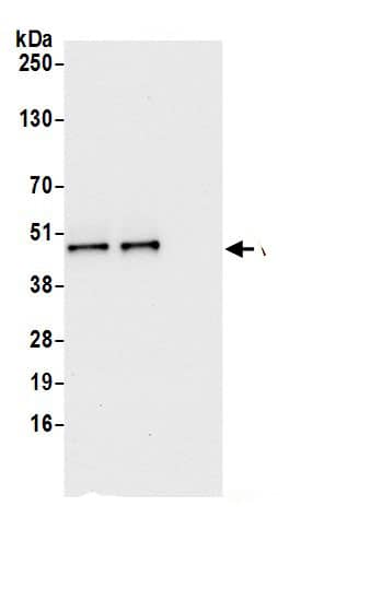Immunoprecipitation:VRK1 AntibodyNBP3-29515] -Detection of human VRK1 by western blot of immunoprecipitates. Samples: Whole cell lysate (0.5 or 1.0 mg per IP reaction; 20% of IP loaded) from HeLa cells prepared using NETN lysis buffer. Antibodies: Affinity purified rabbit anti-VRK1 antibody NBP3-29515 (lot NBP3-29515-1) used for IP at 6 µg per reaction. VRK1 was also immunoprecipitated by rabbit anti-VRK1.. For blotting immunoprecipitated VRK1, NBP3-29515 was used at 1 µg/ml. Detection: Chemiluminescence with an exposure time of 10 seconds.