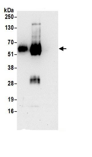 Immunoprecipitation:LAX1 AntibodyNBP3-29516] -Detection of human LAX by western blot of immunoprecipitates. Samples: Whole cell lysate (1 mg for IP; 20% of IP loaded) prepared using RIPA buffer from Jurkat cells. Antibodies: Affinity purified rabbit anti-LAX antibody NBP3-29516 (lot NBP3-29516-1) used for IP at 6 µg per reaction. LAX was also immunoprecipitated by rabbit anti-LAX antibody BL16833. For blotting immunoprecipitated LAX, NBP3-29516 was used at 1 µg/ml. Detection: Chemiluminescence with an exposure time of 30 seconds.