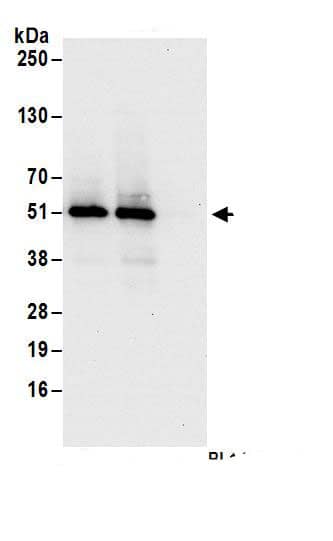 Immunoprecipitation:SEC62 AntibodyNBP3-29517] -Detection of human Sec62 by western blot of immunoprecipitates. Samples: Whole cell lysate (1 mg for IP; 20% of IP loaded) from HeLa cells. Antibodies: Affinity purified rabbit anti-Sec62 antibody NBP3-29517 (lot NBP3-29517-1) used for IP at 6 µg/mg lysate. Sec62 was also immunoprecipitated by rabbit anti-Sec62 antibody . For blotting immunoprecipitated Sec62, NBP3-29517 was used at 1 µg/ml. Detection: Chemiluminescence with an exposure time of 10 seconds.