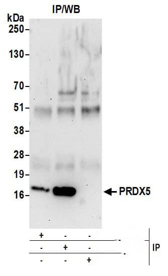 Immunoprecipitation:[NBP3-29520]-Detection of human PRDX5 by western blot of immunoprecipitates. Samples: Whole cell lysate from 293T cells prepared using NETN lysis buffer. Antibodies: Affinity purified rabbit anti-PRDX5 antibody used for IP at 6 µg per reaction. PRDX5 was also immunoprecipitated by rabbit anti-PRDX5 antibody. For blotting immunoprecipitated PRDX5, was used at 1 µg/ml. Detection: Chemiluminescence with an exposure time of 75 seconds.