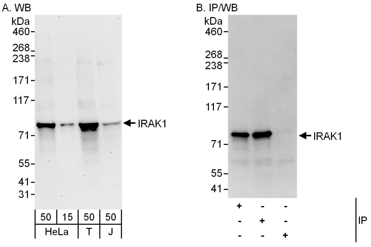 Western Blot:[NBP3-29523]-Detection of human IRAK1 by western blot and immunoprecipitation. Samples: Whole cell lysate from HeLa , HEK293T and Jurkat cells. Antibodies: Affinity purified rabbit anti-IRAK1 antibody used for WB at 0. 1 µg/ml and 1 µg/ml and used for IP at 6 µg/mg lysate. IRAK1 was also immunoprecipitated by rabbit anti-IRAK1 antibody , which recognizes a downstream epitope. Detection: Chemiluminescence with exposure times of 30 seconds and 10 seconds.