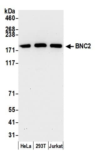 Western Blot BNC2 Antibody