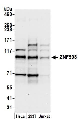Western Blot:[NBP3-29529]-Detection of human ZNF598 by western blot. Samples: Whole cell lysate from HeLa, HEK293T, and Jurkat cells prepared using NETN lysis buffer. Antibody: Affinity purified rabbit anti-ZNF598 antibody used for WB at 0. 04 µg/ml. Detection: Chemiluminescence with an exposure time of 30 seconds.
