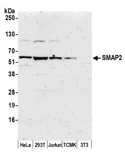 Western Blot:[NBP3-29530]-Detection of human and mouse SMAP2 by western blot. Samples: Whole cell lysate from HeLa, HEK293T, Jurkat, mouse TCMK-1, and mouse NIH 3T3 cells prepared using NETN lysis buffer. Antibody: Affinity purified rabbit anti-SMAP2 antibody used for WB at 0. 1 mg/ml. Detection: Chemiluminescence with an exposure time of 3 minutes.