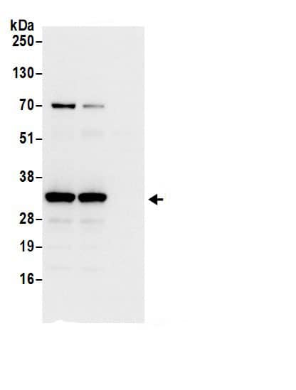 Immunoprecipitation:RPS3A AntibodyNBP3-29537] -Detection of human Ribosomal Protein S3A by western blot of immunoprecipitates. Samples: Whole cell lysate (0.5 or 1.0 mg per IP reaction; 20% of IP loaded) from 293T cells prepared using NETN lysis buffer. Antibodies: Affinity purified rabbit anti-Ribosomal Protein S3A antibody NBP3-29537 (lot NBP3-29537-1) used for IP at 6 µg per reaction. Ribosomal Protein S3A was also immunoprecipitated by rabbit anti-Ribosomal Protein S3A.. For blotting immunoprecipitated Ribosomal Protein S3A, NBP3-29537 was used at 0.4 µg/ml. Detection: Chemiluminescence with an exposure time of 3 seconds.