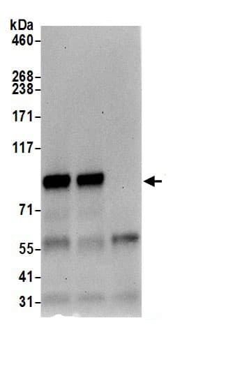 Immunoprecipitation:TRMT1L AntibodyNBP3-29538] -Detection of human TRMT1L by western blot of immunoprecipitates. Samples: Whole cell lysate (0.5 or 1.0 mg per IP reaction; 20% of IP loaded) from HeLa cells prepared using NETN lysis buffer. Antibodies: Affinity purified rabbit anti-TRMT1L antibody NBP3-29538 (lot NBP3-29538-1) used for IP at 6 µg per reaction. TRMT1L was also immunoprecipitated by rabbit anti-TRMT1L antibody BL20171. For blotting immunoprecipitated TRMT1L, NBP3-29538 was used at 0.1 µg/ml. Detection: Chemiluminescence with an exposure time of 30 seconds.