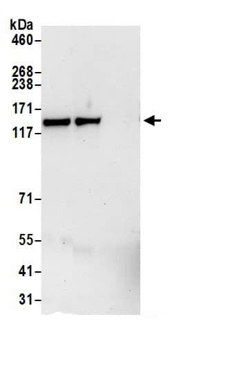 Immunoprecipitation:DIAPH3 AntibodyNBP3-29539] -Detection of human DIAPH3 by western blot of immunoprecipitates. Samples: Whole cell lysate (0.5 or 1.0 mg per IP reaction; 20% of IP loaded) from HeLa cells prepared using NETN lysis buffer. Antibodies: Affinity purified rabbit anti-DIAPH3 antibody NBP3-29539 (lot NBP3-29539-1) used for IP at 6 µg per reaction. DIAPH3 was also immunoprecipitated by rabbit anti-DIAPH3.. For blotting immunoprecipitated DIAPH3, NBP3-29539 was used at 1 µg/ml. Detection: Chemiluminescence with an exposure time of 30 seconds.