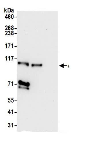 Immunoprecipitation:NCKAP1 AntibodyNBP3-29540] -Detection of human NCKAP1 by western blot of immunoprecipitates. Samples: Whole cell lysate (0.5 or 1.0 mg per IP reaction; 20% of IP loaded) from 293T cells prepared using NETN lysis buffer. Antibodies: Affinity purified rabbit anti-NCKAP1 antibody NBP3-29540 (lot NBP3-29540-1) used for IP at 6 µg per reaction. NCKAP1 was also immunoprecipitated by rabbit anti-NCKAP1.. For blotting immunoprecipitated NCKAP1, NBP3-29540 was used at 0.4 µg/ml. Detection: Chemiluminescence with an exposure time of 10 seconds.